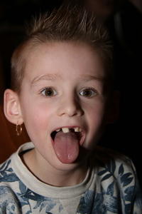 IMG 9963